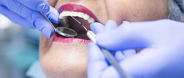Best Emergency Dental Care for Broken or Chipped Teeth in Denton, MD