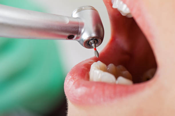 Best Weekend Emergency Dentist in Denton, MD